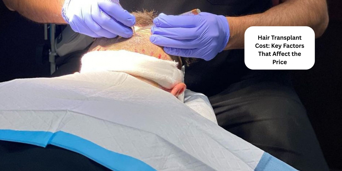 Hair Transplant Cost: Key Factors That Affect the Price