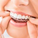 Teeth Braces in Chennai Profile Picture
